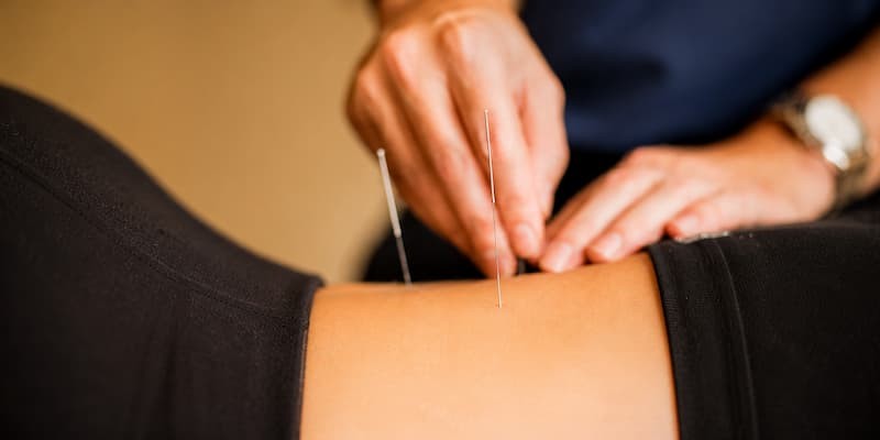 Setauket Acupuncturist on the Orthopedic Approach to Chronic Pain Care